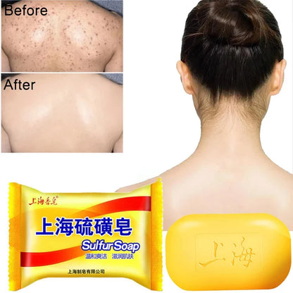 Asia Sulfur Soap –  for Face & Body for Skin Oil Control Facial Cleansing Healthy Clean Skin Care