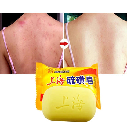 Asia Sulfur Soap –  for Face & Body for Skin Oil Control Facial Cleansing Healthy Clean Skin Care